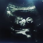 Juan Marshall Thiago Jimenez - @shadybabythiago27 - Instagram
