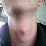 kacey Franklin adams apple - @kcs_adams_apple - Instagram