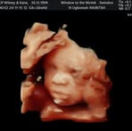 Kane Stanton - Facebook