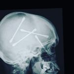 Karl Blau - @blausteinerkarl - Instagram