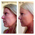 Katie Hackett - @beautiful_skin_from_katie - Instagram