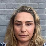 Keely Adams - @amputee_keely - Instagram