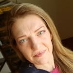 Kristi Berg - @scarredxbeauty - Instagram