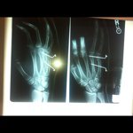 K Quik - @kylebrashear - Instagram