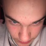 🦨🍥 - @kylespringpriv - Instagram
