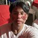 Lawrence Parico - Facebook