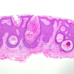 Leah Swanson, MD, FAAD - @leahswansonmd - Instagram