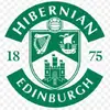 leighachaney - @hibs102 - TikTok