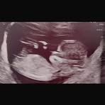 Lennox Morrison - Facebook