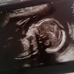 Lennox Christopher Simpson - @ourlennox - Instagram