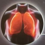 Dr Leon Naidoo - @pulmonology_northcoast - Instagram