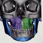 Lewis Jones/Greg Way/ Matt Stratton DMD, MD - @omfs_ky - Instagram