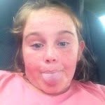 Lilli Mclean - @spudtoe - Instagram