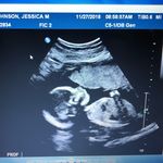 Sweet Baby lily ❤️ - @lilyannkillian - Instagram