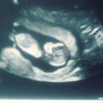 Lisa Aviles - @aviles7105 - Instagram