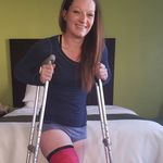 Lisa Terwilliger - @leg_casted - Instagram