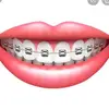 Fake braces - @braces_lola.hunter - TikTok