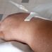 Hopital Louis Constant Fleming - Facebook