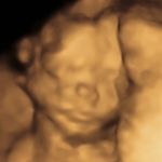 Louise Redding - @mybabyboy0507 - Instagram