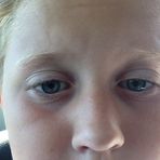 Lukas Jacobson - Facebook