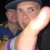 Luke William - @wonky_eyes - TikTok