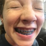 Lydia burnham - @lb.spamzzzz - Instagram