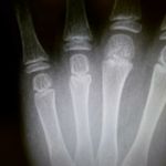 Lyman Lee - @lymanxray - Instagram