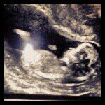 Lynn Bissonnette - @mackenziesmommy3 - Instagram