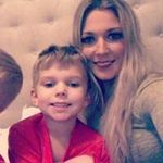 Lynn Vitale - @laserbodysculpting - Instagram