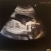 Madalyn Turner - Facebook