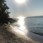 Maggie Leonard - @living_limbitless - Instagram