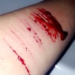 Malika Logan Mutilation - Facebook