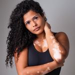 Mara Castro | Vitiligo | Autoestima | Esportes - @maraa_castrro - Instagram
