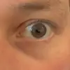 Marc's linkes Auge - @marcs.linkes.auge - TikTok