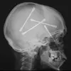 MarcelSteelgray - @marcelsteelgrey - TikTok