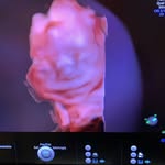 Dr Maria Simou - @embryoplus_dr_maria_simou - Instagram