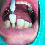 @mariobrega - Instagram