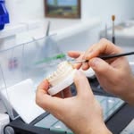 Lab-Dental, prótesis fija. - @mario.pons715 - Instagram