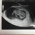 Matthew Greer - @matthew.greer.1804 - Instagram