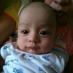 Matt Albao - Facebook