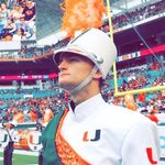 Max Baldwin - @max_hairloss - Instagram
