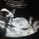 Melanie Cartwright - @mummatoanangel11 - Instagram