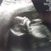 Melissa Craddock - Facebook