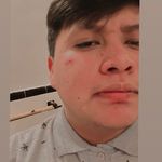 Melvin Rojas - @melvin_rojass - Instagram