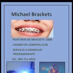 Michael - @michael_brackets - Instagram