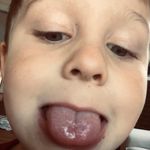 Michael Hertzog - @bigbika31 - Instagram