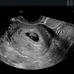 Michael Misher - Facebook