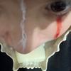 michaelsurgeon4 - @michaelsurgeon4 - TikTok