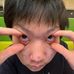 Michael Yip - Facebook