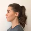 Michelle | Kieferfehlstellung - @michelle.malin - TikTok